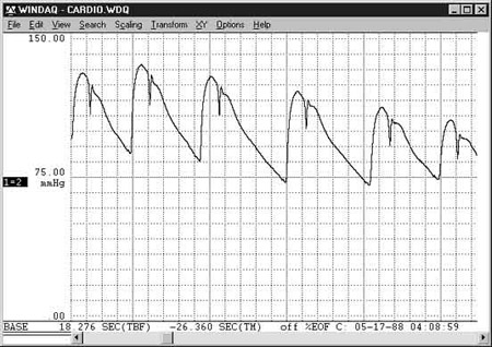 Data Acquisition Waveform - mmHg