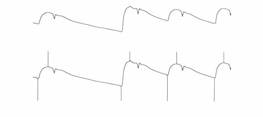 Data Acquisition Waveform - Peak and Valley Capture